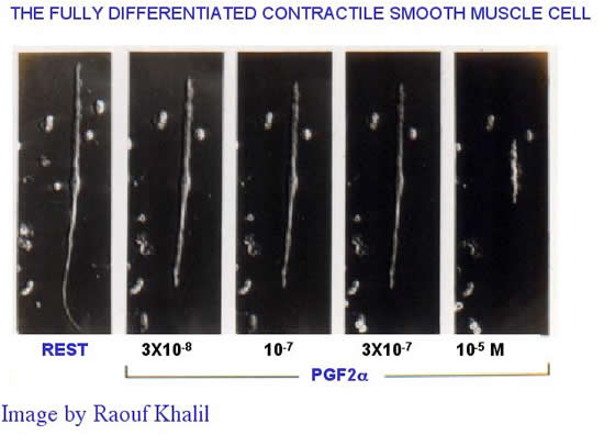 The Fully Differentiated Contractile Smooth Muscle Cell. Image by Raouf Khalil