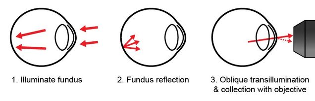 Retroillumination corneal imaging | Biomicroscopy Lab