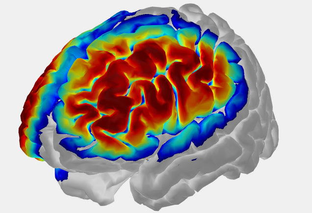 Brain imaging using infrared spectroscopy (fNIRS)