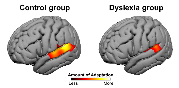 dyslexia-adaptation-figure_web_small