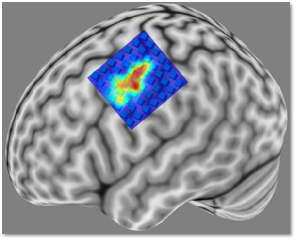 TMS brain map showing motor cortex activation