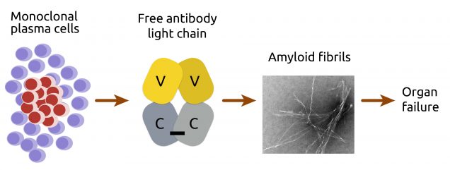 Plasma cells -> free light chain -> amyloid fibrils -> organ failure