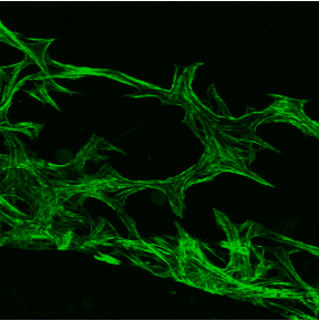 Lymphatic vessel damage