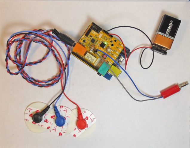 A small circuit board is connected to a battery. There are three cords leading out of the device with a round sensor attached to each one